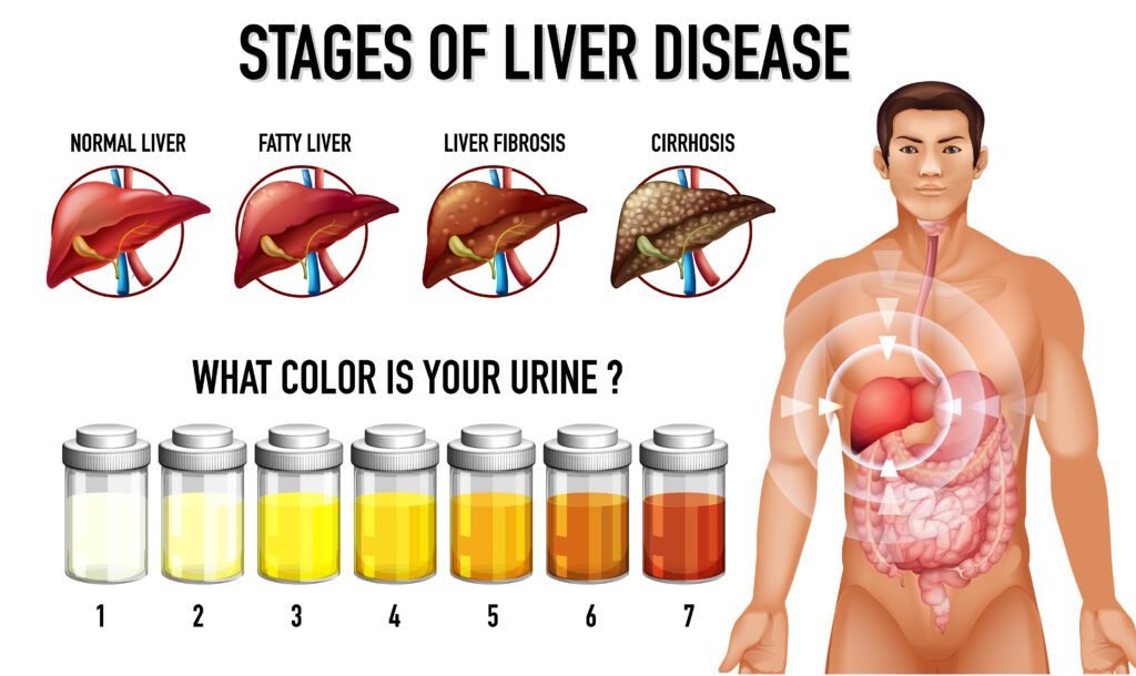 15 Natural Remedies for Fatty Liver Disease & Causes 3 natural remedies for fatty liver disease