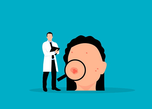 Hormonal Rash On Face 